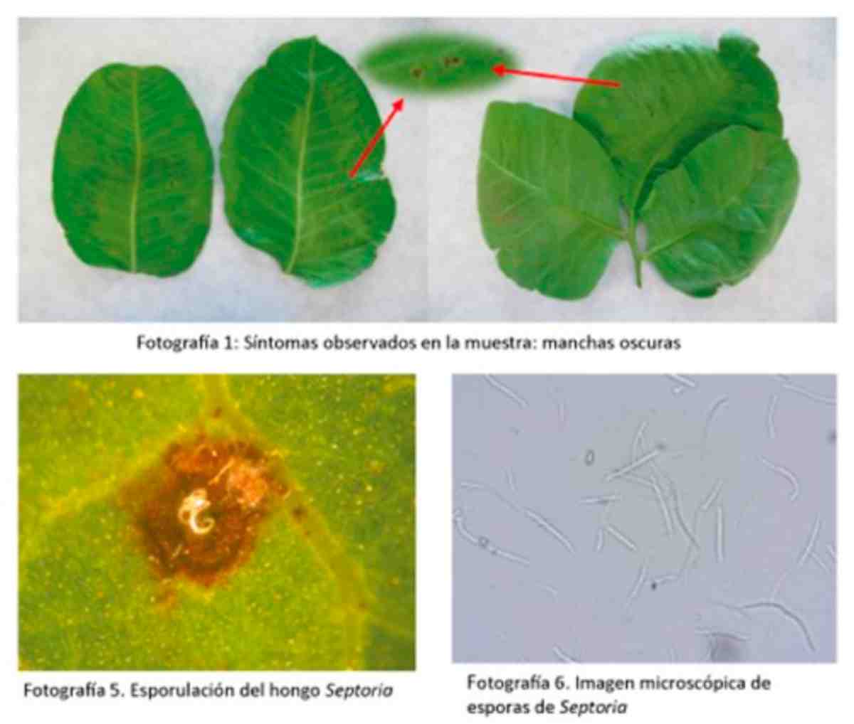 septoria pistacho